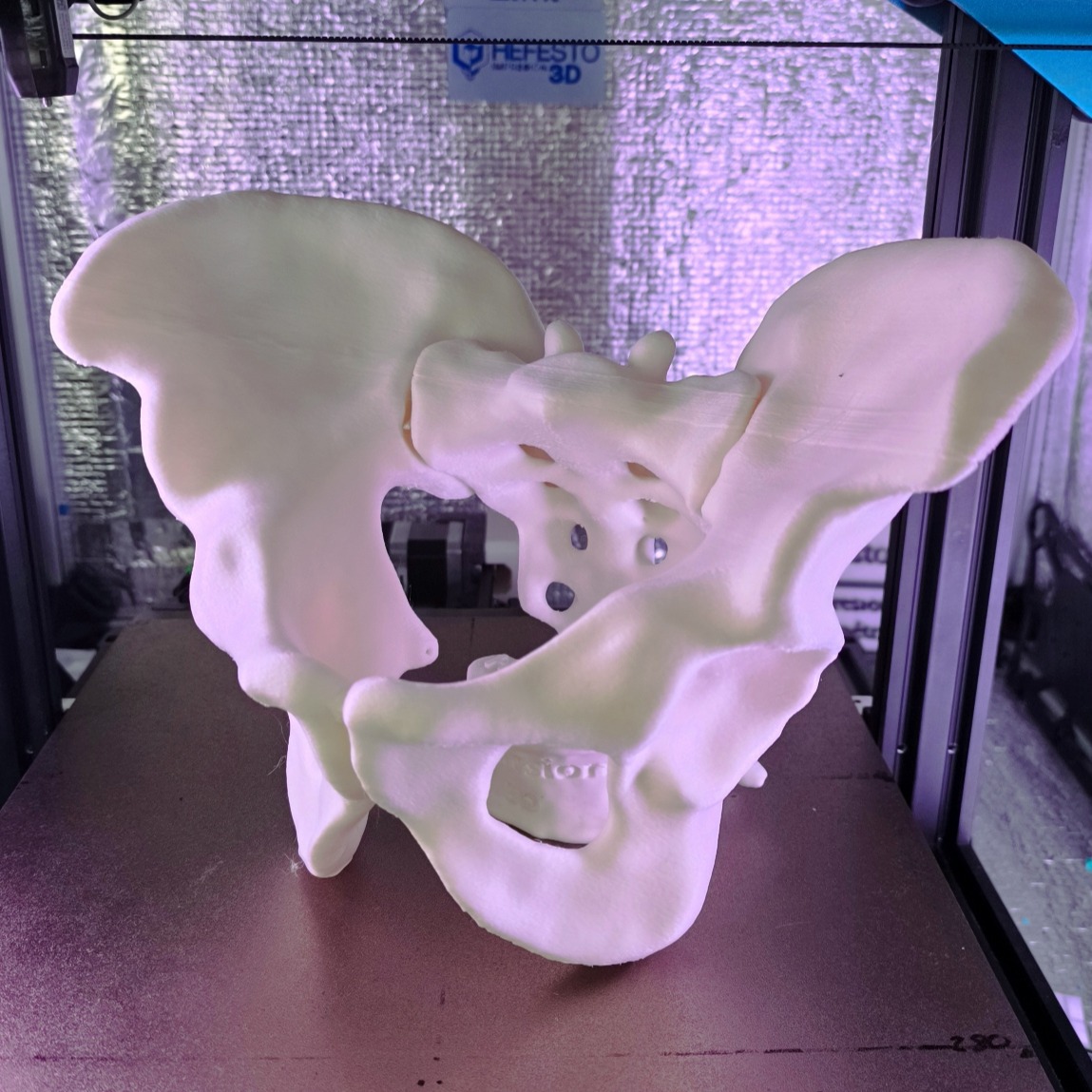 Pelvis completa